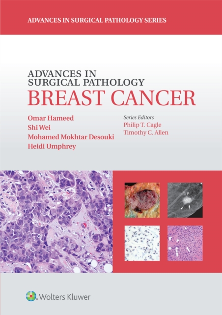 Advances in Surgical Pathology: Breast Cancer, Hardback Book