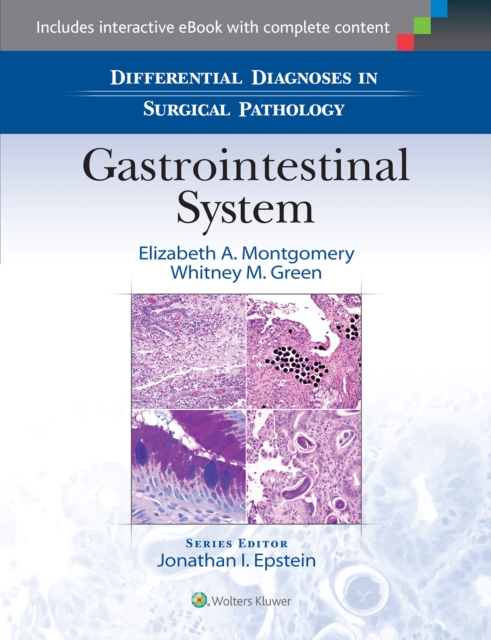 Differential Diagnoses in Surgical Pathology: Gastrointestinal System, Hardback Book