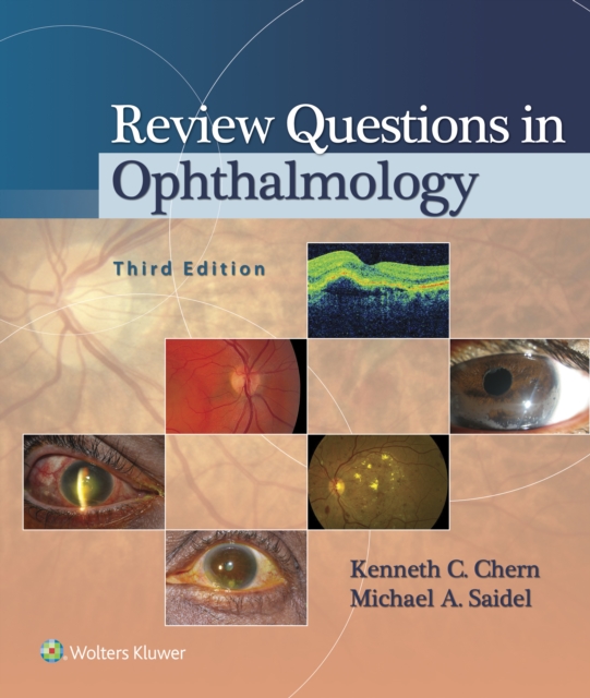 Review Questions in Ophthalmology, Paperback / softback Book