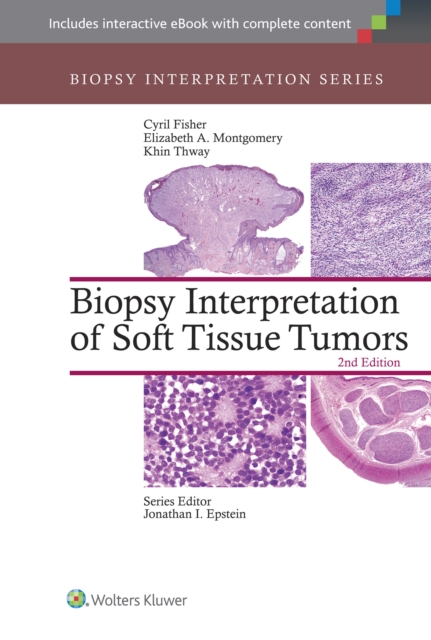 Biopsy Interpretation of Soft Tissue Tumors, Hardback Book