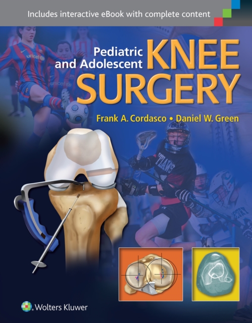 Pediatric and Adolescent Knee Surgery, Hardback Book