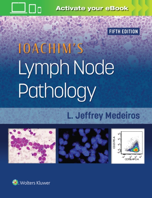 Ioachim's Lymph Node Pathology, Hardback Book