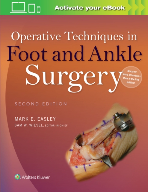 Operative Techniques in Foot and Ankle Surgery, Hardback Book