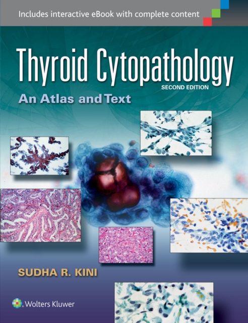 Thyroid Cytopathology : An Atlas and Text, Hardback Book