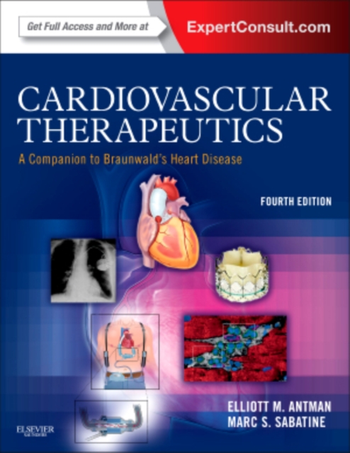 Cardiovascular Therapeutics - A Companion to Braunwald's Heart Disease : Expert Consult - Online and Print, Hardback Book