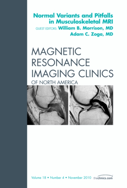 Normal Variants and Pitfalls in Musculoskeletal MRI, An Issue of Magnetic Resonance Imaging Clinics : Volume 18-4, Hardback Book