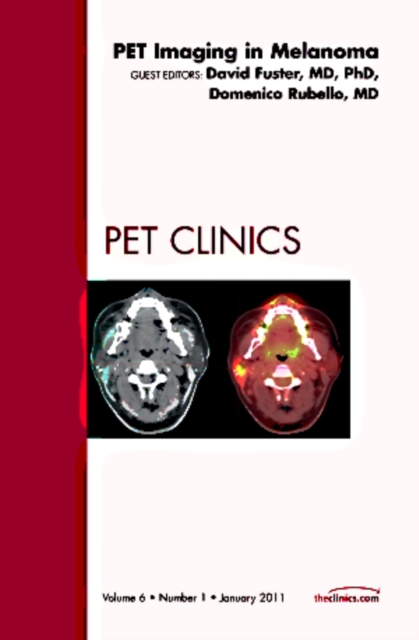 Pet Imaging in Melanoma, An Issue of PET Clinics : Volume 6-1, Hardback Book