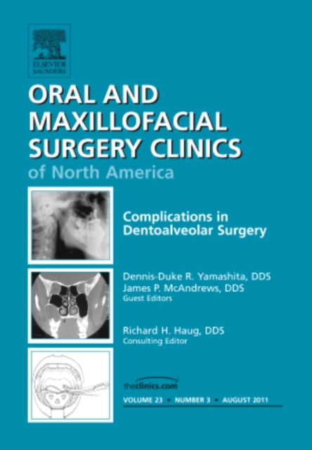 Complications in Dento-Alveolar Surgery, An Issue of Oral and Maxillofacial Surgery Clinics : Volume 23-3, Hardback Book