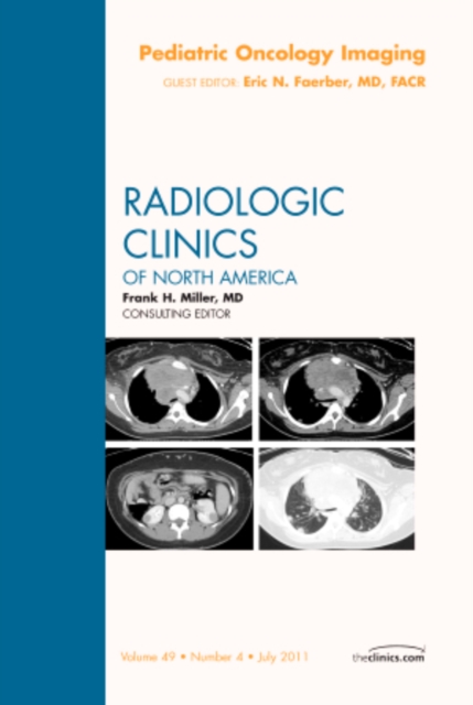 Pediatric Oncology Imaging, An Issue of Radiologic Clinics of North America : Volume 49-4, Hardback Book