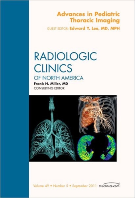 Advances in Pediatric Thoracic Imaging, An Issue of Radiologic Clinics of North America : Volume 49-5, Hardback Book