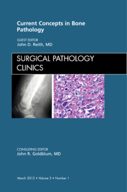 Current Concepts in Bone Pathology, An Issue of Surgical Pathology Clinics : Volume 5-1, Hardback Book