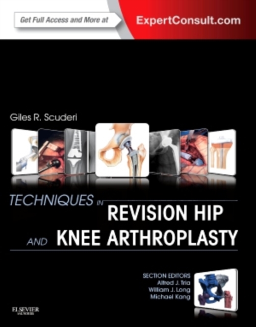 Techniques in Revision Hip and Knee Arthroplasty, Hardback Book