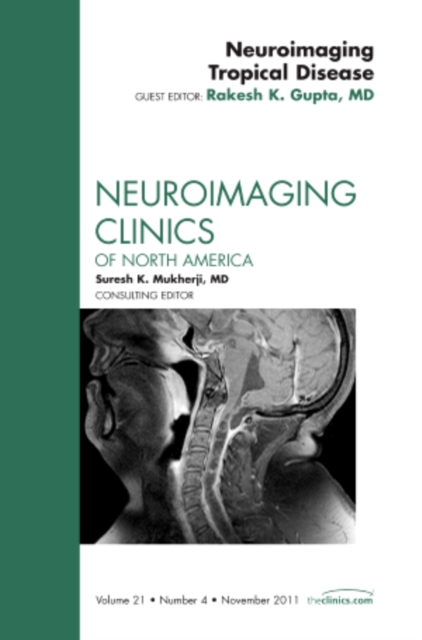 Neuroimaging Tropical Disease, An Issue of Neuroimaging Clinics : Volume 21-4, Hardback Book