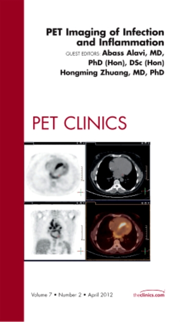 PET Imaging of Infection and Inflammation, An Issue of PET Clinics : Volume 7-2, Hardback Book