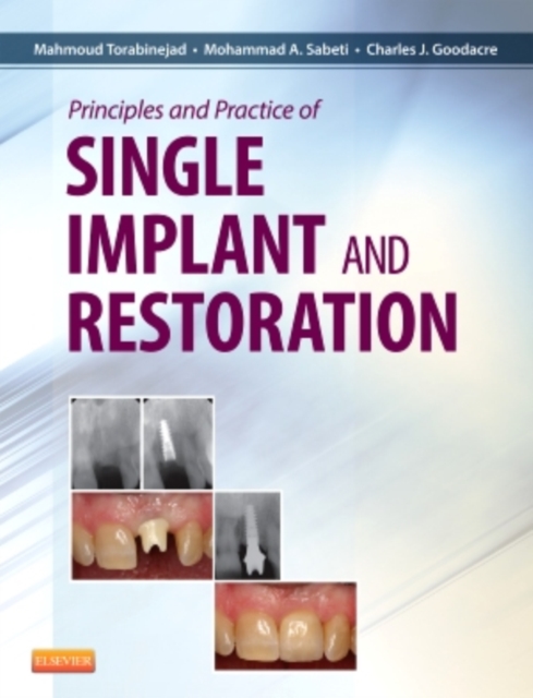 Principles and Practice of Single Implant and Restoration, Hardback Book