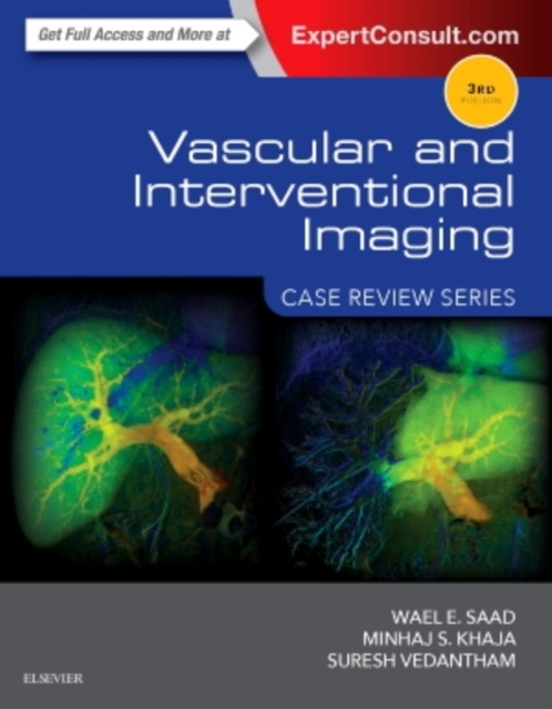 Vascular and Interventional Imaging: Case Review Series, Paperback / softback Book