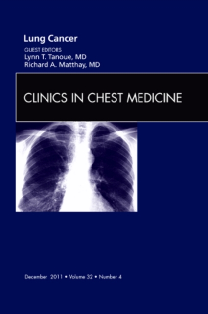 Lung Cancer, An Issue of Clinics in Chest Medicine : Volume 32-4, Hardback Book