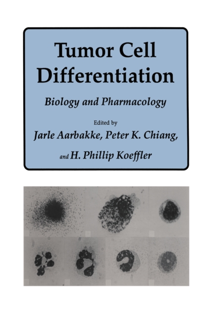Tumor Cell Differentiation : Biology and Pharmacology, PDF eBook