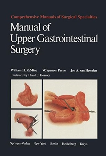 Manual of Upper Gastrointestinal Surgery, Paperback / softback Book