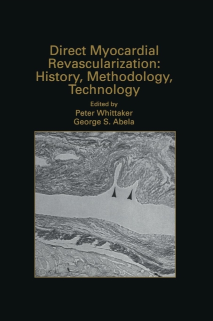 Direct Myocardial Revascularization: History, Methodology, Technology, Paperback / softback Book