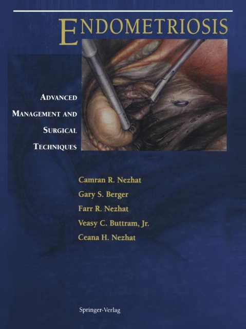 Endometriosis : Advanced Management and Surgical Techniques, Paperback / softback Book