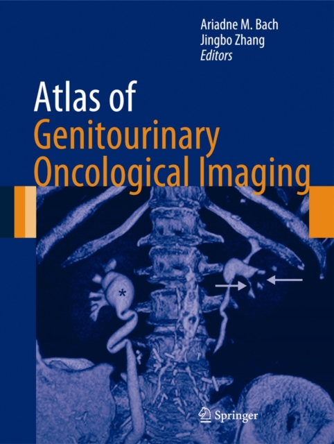 Atlas of Genitourinary Oncological Imaging, Hardback Book