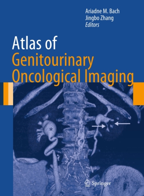Atlas of Genitourinary Oncological Imaging, PDF eBook