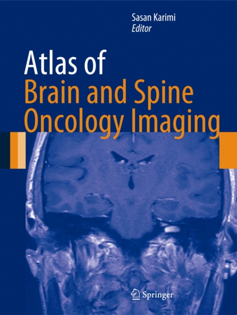 Atlas of Brain and Spine Oncology Imaging, Hardback Book