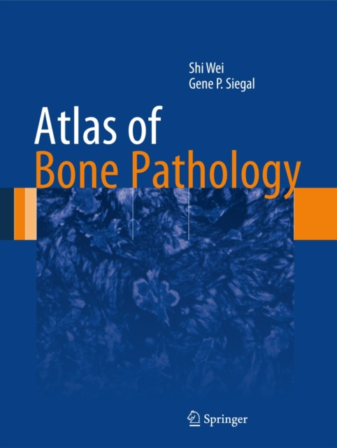 Atlas of Bone Pathology, Hardback Book