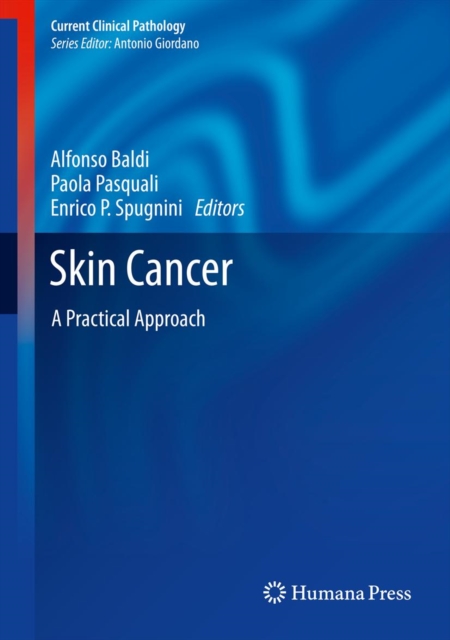 Skin Cancer : A Practical Approach, PDF eBook