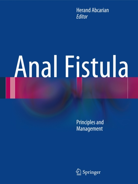 Anal Fistula : Principles and Management, Hardback Book