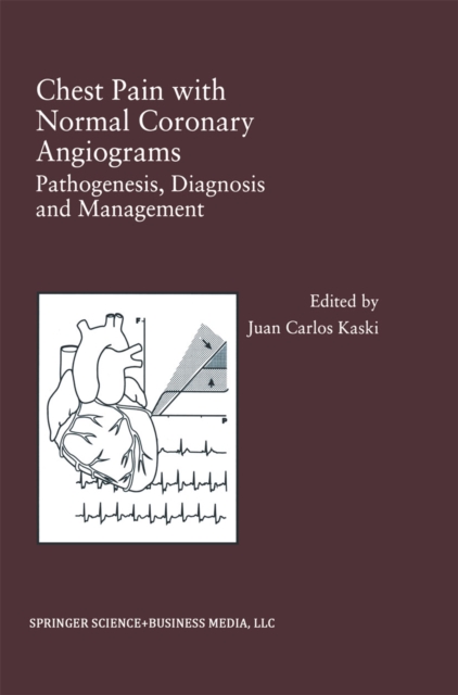 Chest Pain with Normal Coronary Angiograms: Pathogenesis, Diagnosis and Management, PDF eBook