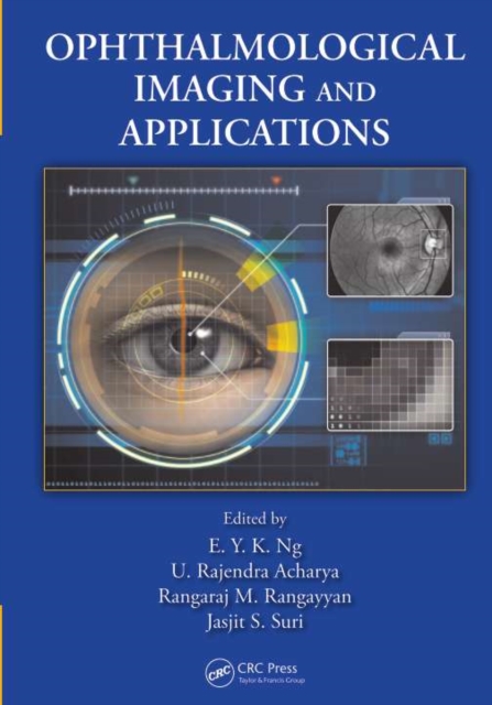 Ophthalmological Imaging and Applications, PDF eBook