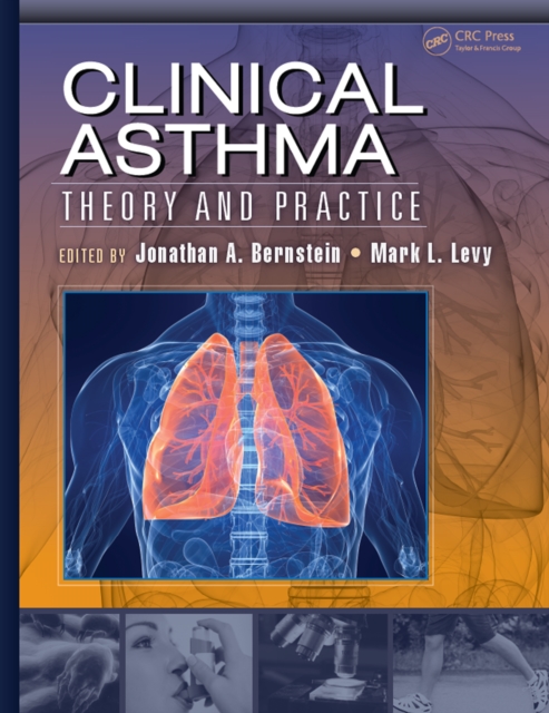 Clinical Asthma : Theory and Practice, PDF eBook