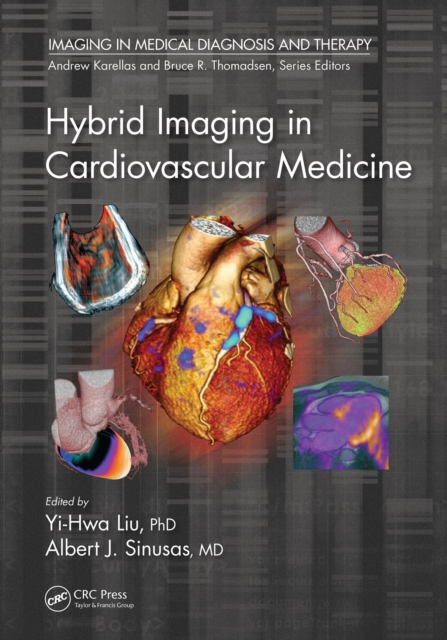Hybrid Imaging in Cardiovascular Medicine, PDF eBook