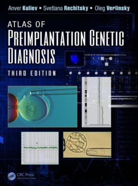 Atlas of Preimplantation Genetic Diagnosis, Hardback Book