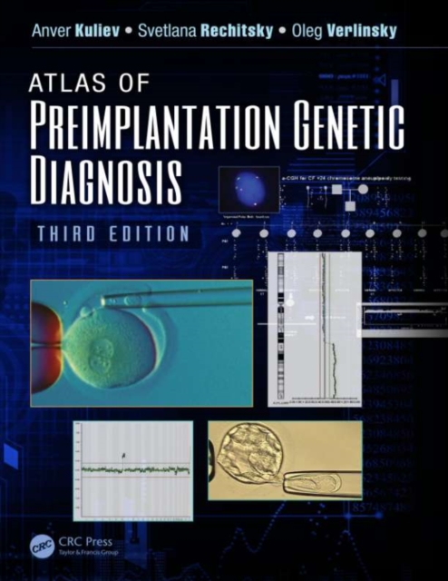 Atlas of Preimplantation Genetic Diagnosis, PDF eBook