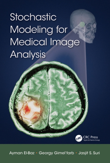 Stochastic Modeling for Medical Image Analysis, PDF eBook