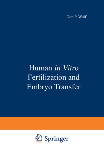 Human in Vitro Fertilization and Embryo Transfer, PDF eBook