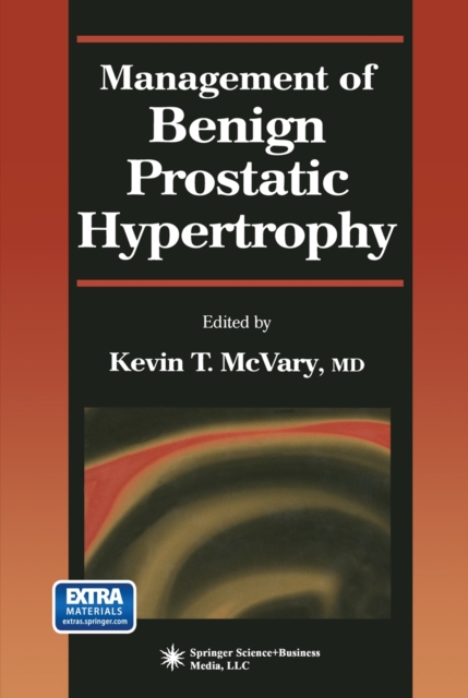Management of Benign Prostatic Hypertrophy, Paperback / softback Book