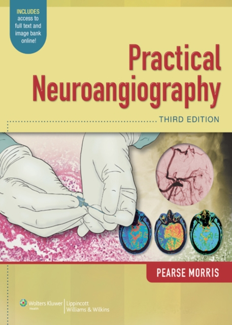 Practical Neuroangiography, EPUB eBook