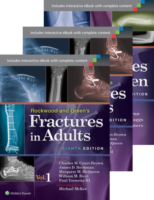 Rockwood, Green, and Wilkins' Fractures in Adults and Children  Package, Mixed media product Book