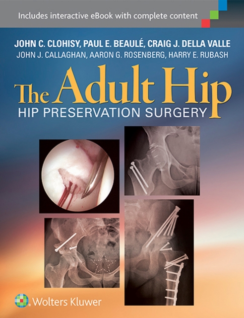 The Adult Hip : Hip Preservation Surgery, EPUB eBook
