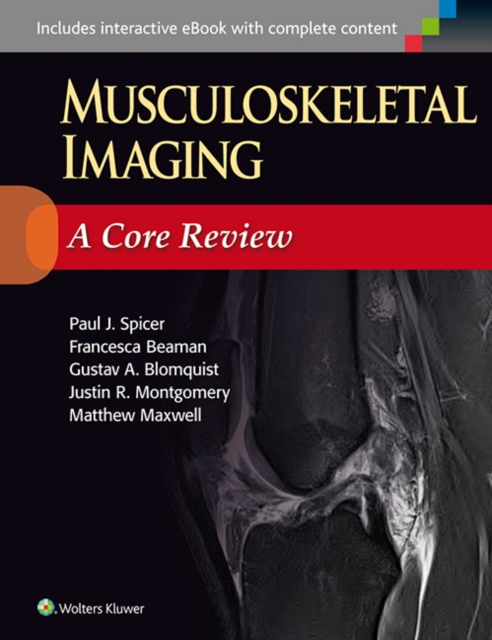 Musculoskeletal Imaging: A Core Review, EPUB eBook
