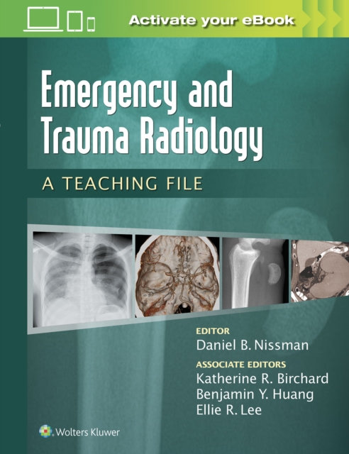 Emergency and Trauma Radiology: A Teaching File, Paperback / softback Book