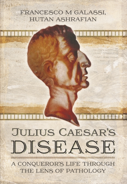 Julius Caesar's Disease, Hardback Book