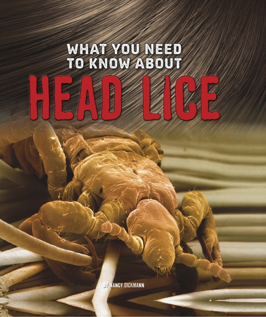 What You Need to Know about Head Lice, Hardback Book