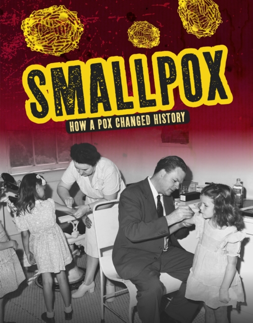 Smallpox : How a Pox Changed History, Paperback / softback Book