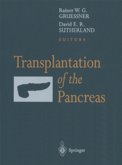 Transplantation of the Pancreas, PDF eBook