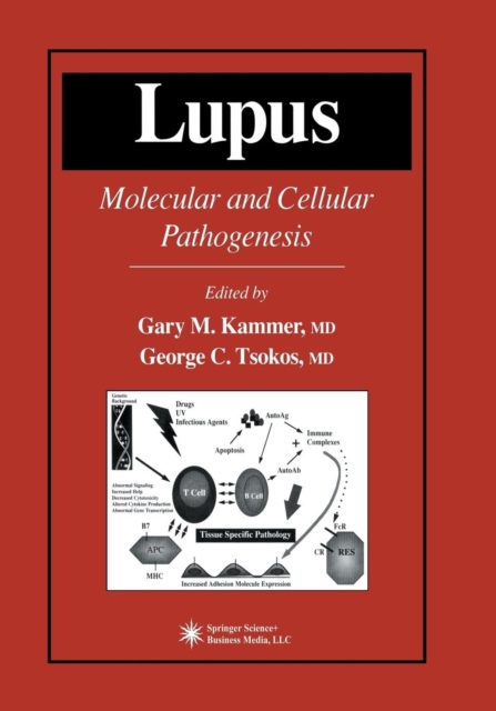 Lupus : Molecular and Cellular Pathogenesis, Paperback / softback Book
